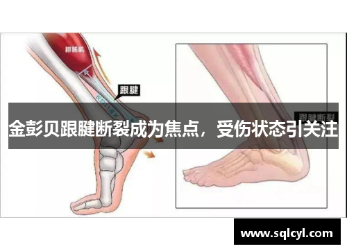 金彭贝跟腱断裂成为焦点，受伤状态引关注